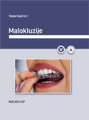 MALOKLUZIJE