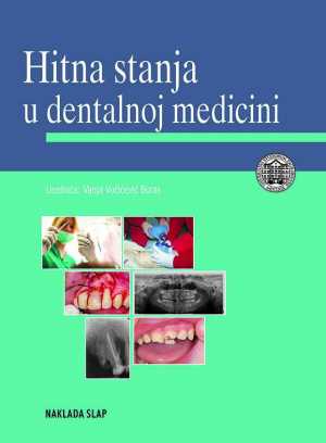 HITNA STANJA U DENTALNOJ MEDICINI