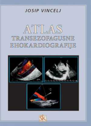 ATLAS TRANSEZOFAGUSNE EHOKARDIOGRAFIJE