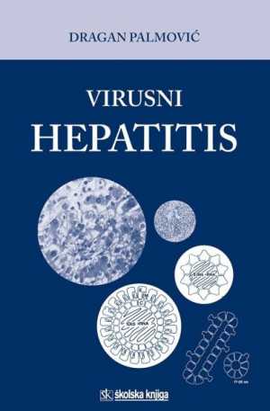 VIRUSNI HEPATITIS