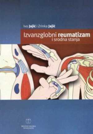 IZVANZGLOBNI REUMATIZAM I SRODNA STANJA PRIRUČNIK ZA REUMATOLOGE, FIZIJATRE, INTERNISTE, ORTOPEDE, MEDICINARE RADA I LIJEČNIKE OPĆE MEDICINE