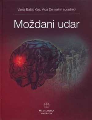 MOŽDANI UDAR