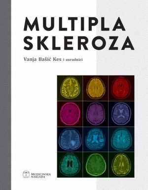 MULTIPLA SKLEROZA