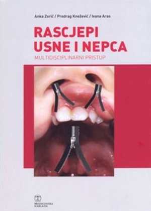 RASCJEPI USNE I NEPCA MULTIDISCIPLINARNI PRISTUP