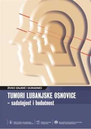 TUMORI LUBANJSKE OSNOVICE SADAŠNJOST I BUDUĆNOST