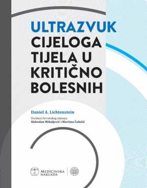 ULTRAZVUK CIJELOGA TIJELA U KRITIČNO BOLESNIH