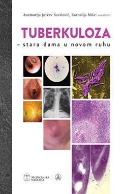 TUBERKULOZA - STARA DAMA U NOVOM RUHU