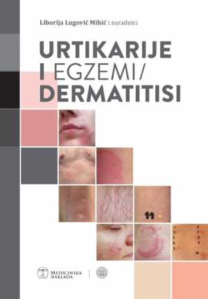 URTIKARIJE I EGZEMI / DERMATITISI