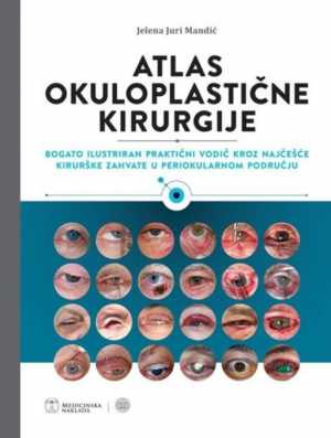 ATLAS OKULOPLASTIČNE KIRURGIJE