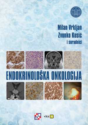ENDOKRINOLOŠKA ONKOLOGIJA